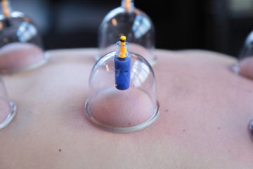ACE Massage cupping
